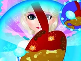 Elsa Abdominal Surgery