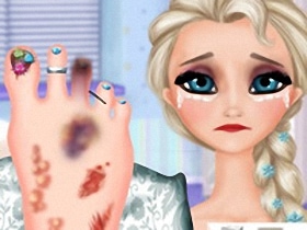 Elsa Foot Injured